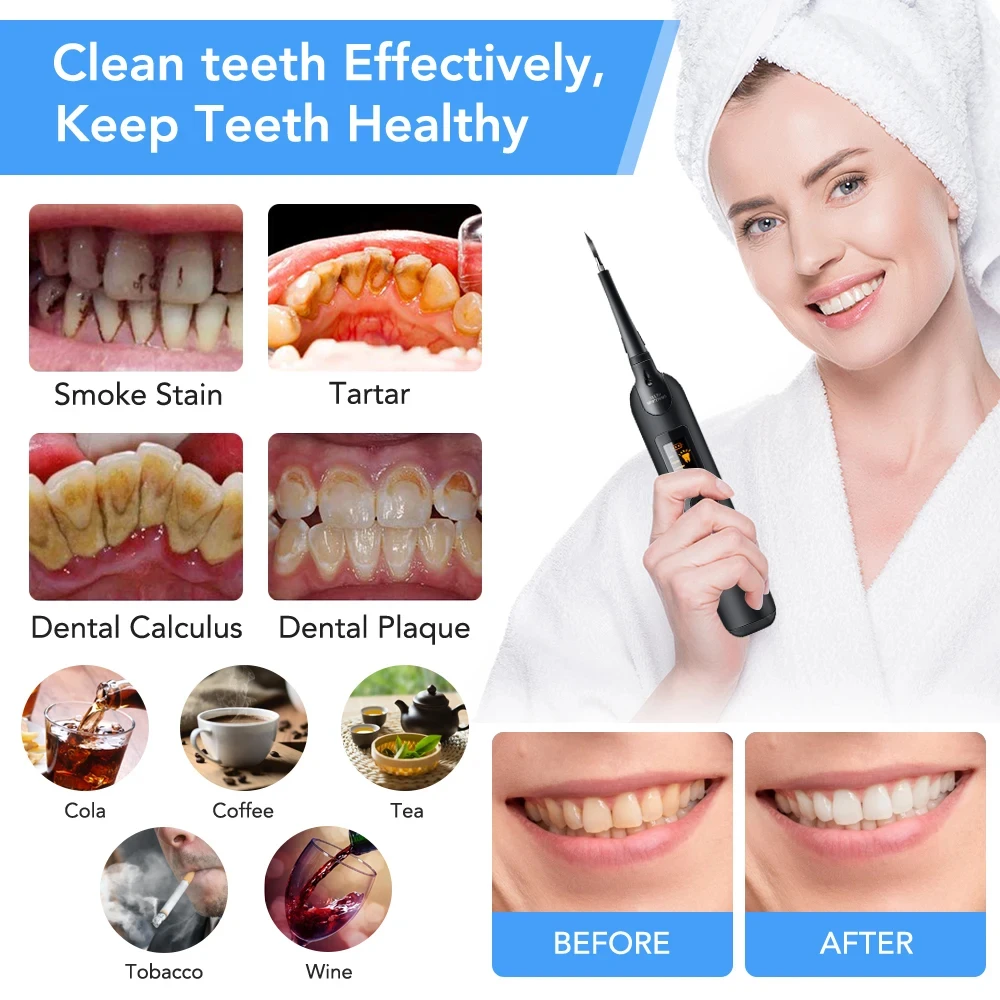 LED Sonic Tooth Cleaner & Whitening Electric Scaler Set - Image 3
